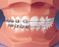 Wetherby Orthodontics Invisalign and Incognito invisible braces 153135 Image 1