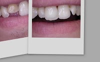 oneonenine dental 150481 Image 4